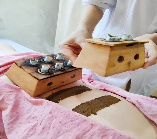 广东股票配资公司 周日入初伏，抓住时机“三伏灸”调出健康好气色